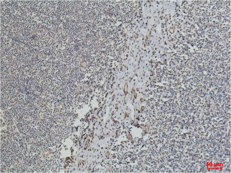 Beta-tubulin Monoclonal Antibody (M7)