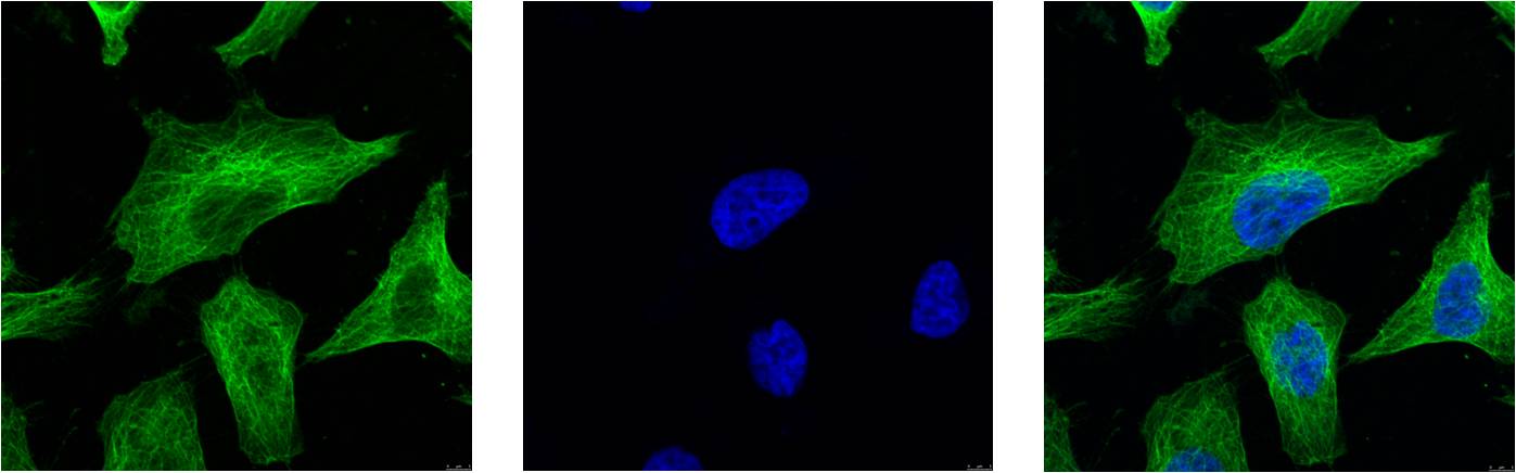 Beta-tubulin Monoclonal Antibody (M7)
