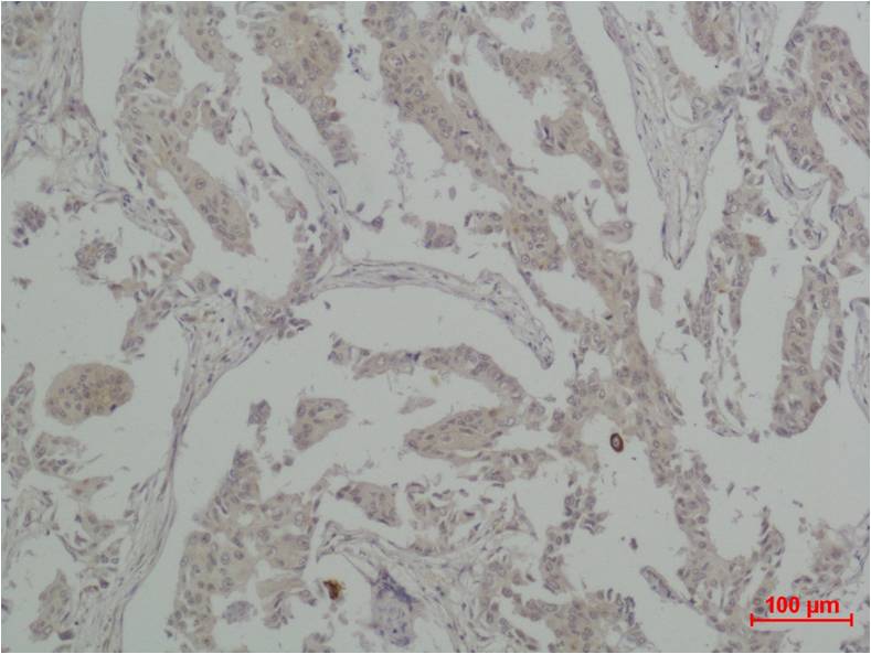 Vinculin Polyclonal Antibody