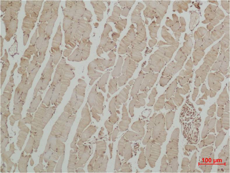 Beta III Tubulin Polyclonal Antibody