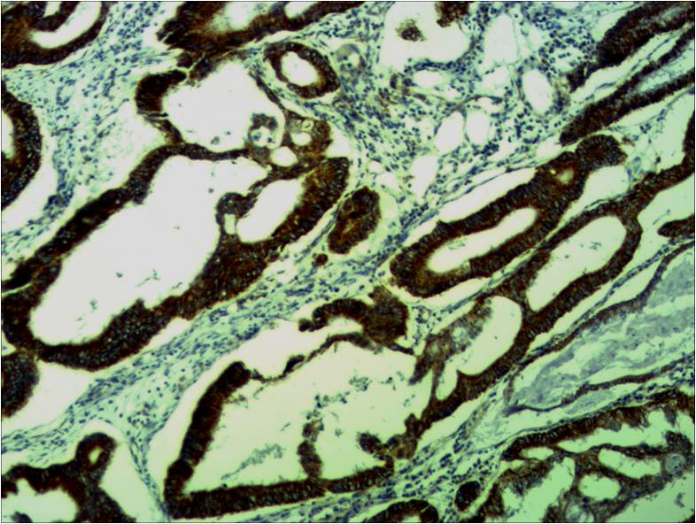 COX IV Polyclonal Antibody