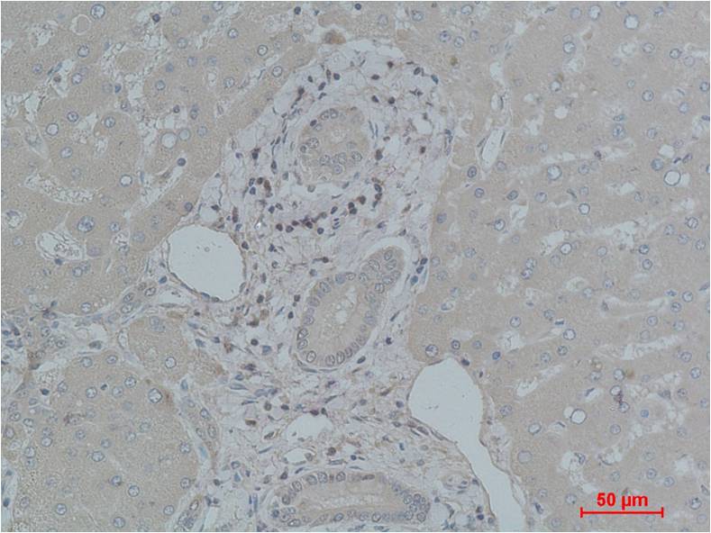 Transferrin Polyclonal Antibody