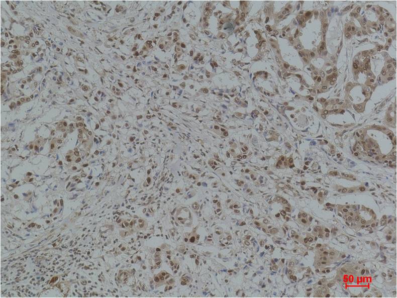 GAPDH Polyclonal Antibody (G04-For Bacterium)
