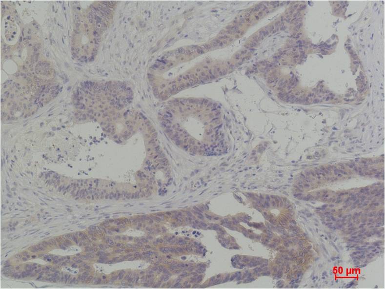 TBP Polyclonal Antibody (TBP)