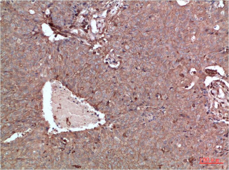 Beta-actin Polyclonal Antibody (A284)