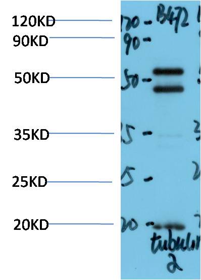 C. Elegans Alpha-tubulin Polyclonal Antibody