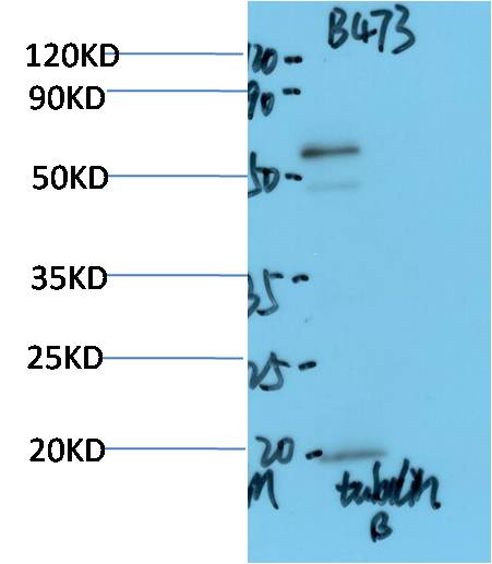 C. Elegans Beta-tubulin Polyclonal Antibody