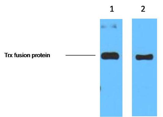 1ug Trx fusion protein+ Primary antibody dilution at  1. 1:5,000  2. 1:10,000