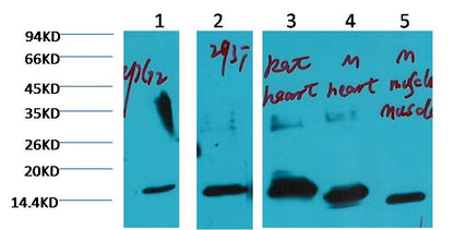 Western blot analysis of 1) HepG2, 2) 293T, 3) Rat Heart, 4) Mouse Heart, 5) Mouse Muscle tissue with COX IV Mouse mAb) diluted at 1:3,000.