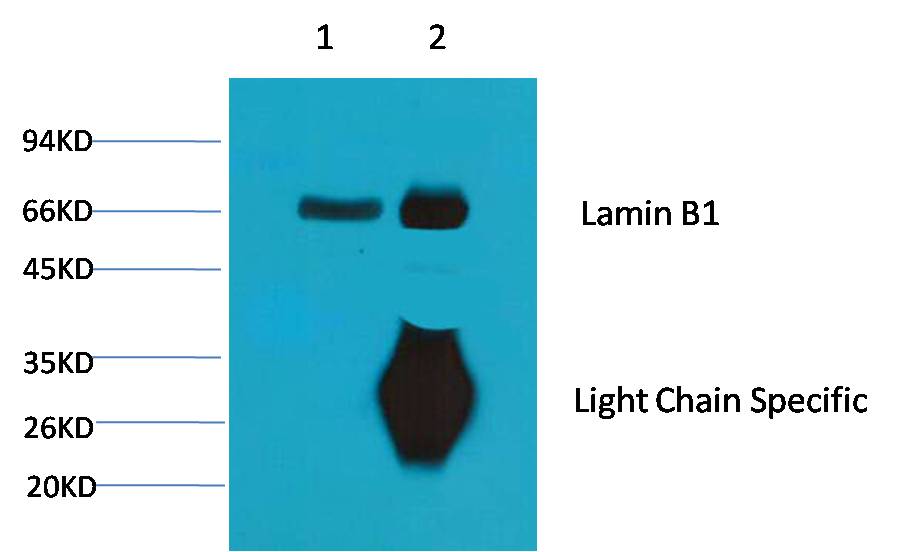 1. Input: Mouse Brain Tissue Lysate  2. IP product: IP dilute 1:200  Western blot analysis: primary antibody : EM1035        1:5,000 Secondary antibody: Goat anti-Mouse IgG, Light chain specific(S003), 1:5,000