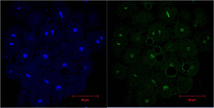 IF analysis of Hela with DAPI (Left) and EM1037(Right) diluted at 1:200.