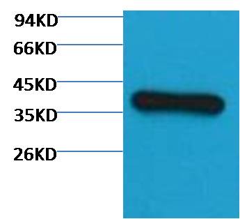 Western blot analysis of Hela with EM1039 diluted at 1:3,000.