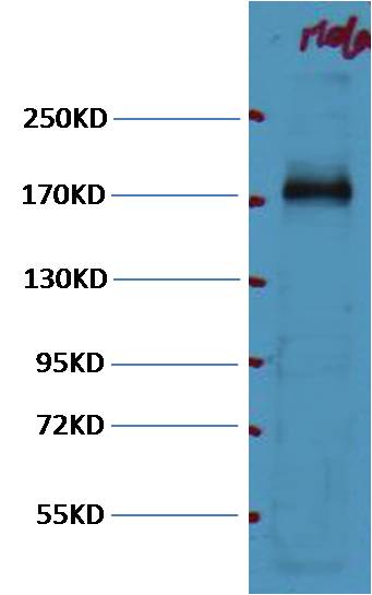 Western blot analysis of Hela with EGFR mAb diluted at 1:1,000.
