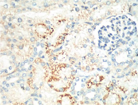 IHC staining of Mouse Kidney tissue with Ki 67 mouse mAb(4A8) diluted at 1:200.