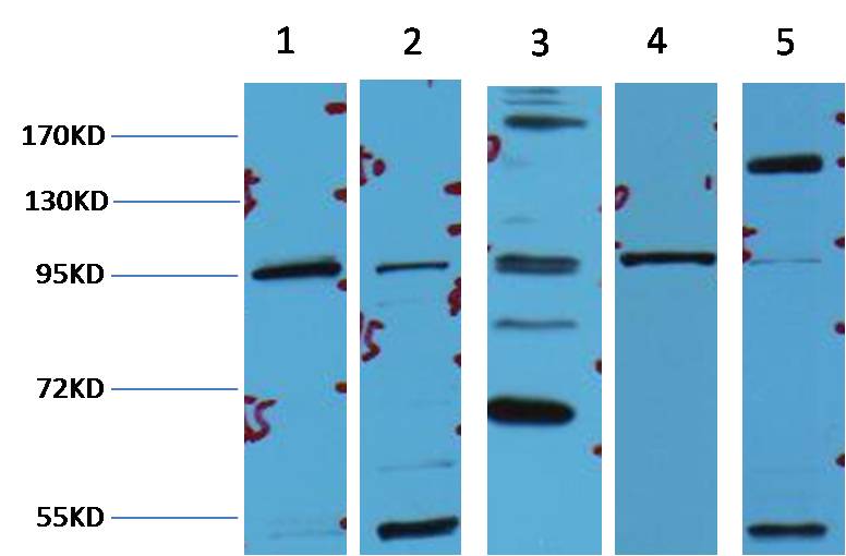 Western blot analysis of 1) Hela, 2) 293T, 3) MCF7, 4)Mouse Brain tissue ,3) Rat LiverTissue with Beta-Catenin mAb diluted at 1:2,000.