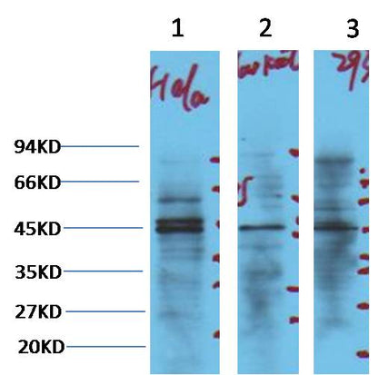 Western blot analysis of 1) Hela, 2) Jurkat, 3) 293T cell lysates with NSE mAb diluted at 1:3,000.