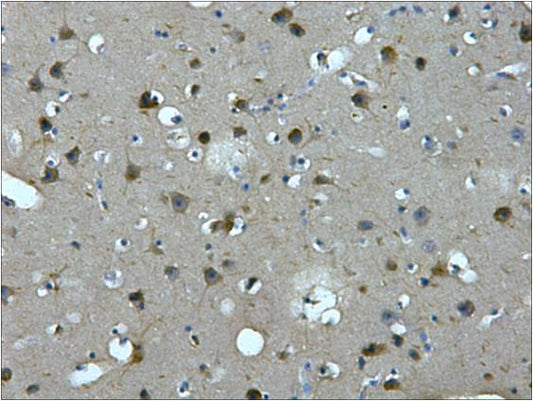 IHC staining of Human brain tissue paraffin-embedded with MAP2 mouse mAb (7D4) diluted at 1:200.