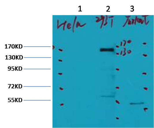 Western blot analysis of 1) Hela, 2) 293, 3) Jurkat,with ErbB-2 Mouse mAb diluted at 1:2,000.