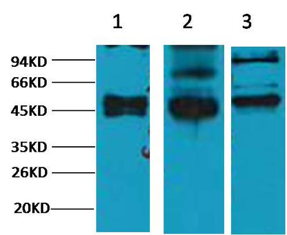 Western blot analysis of 1) Hela, 2) MCF7, 3) 293T, with CK17 Mouse mAb diluted at 1:2,000.