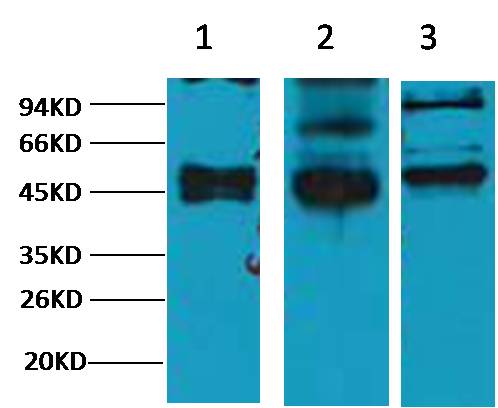 Western blot analysis of 1) Hela, 2) MCF7, 3) 293T, with CK17 Mouse mAb diluted at 1:2,000.