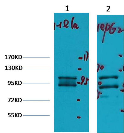 Western blot analysis of 1) Hela, 2) HepG2,with IDE Mouse mAb diluted at 1:2,000.