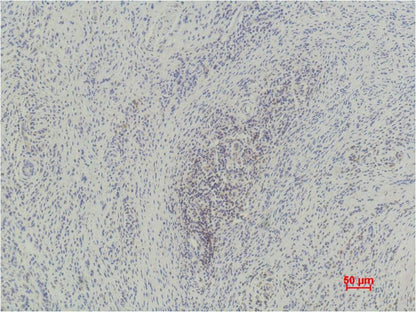 Immunohistochemical analysis of paraffin-embedded Human Skin using  Histone H3(momo methyl K79) (EM1099) Mouse mAb diluted at 1:500.