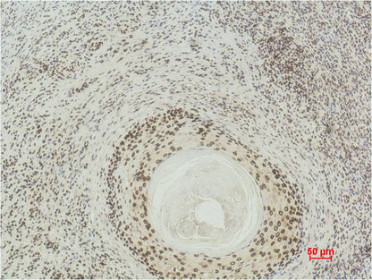 Immunohistochemical analysis of paraffin-embedded Human Skin using  Histone H3(di methyl K27) (EM1101) Mouse mAb diluted at 1:500.