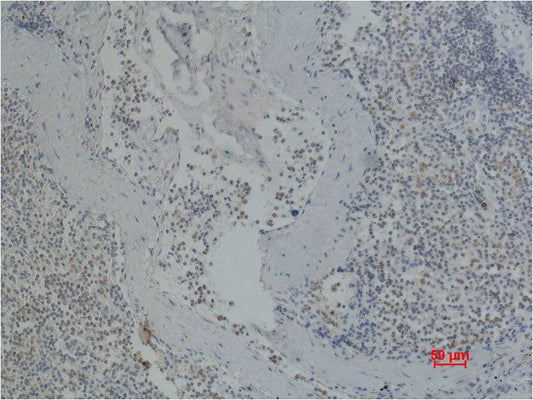 Immunohistochemical analysis of paraffin-embedded Human Spleen using  CD41 (EM1106) Mouse mAb diluted at 1:200.