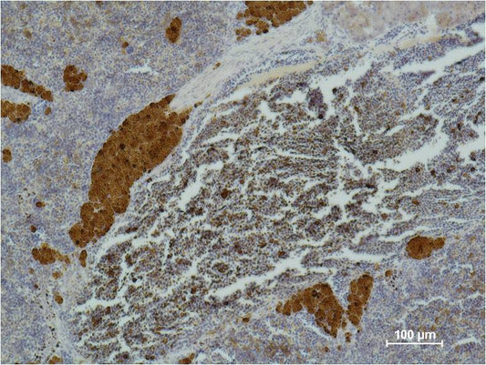 Immunohistochemical analysis of paraffin-embedded Mouse SpleenTissue using CD 25  (EM1107) Mouse mAbdiluted at 1:500.