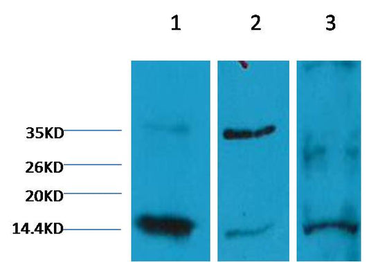 Western blot analysis of 1) Hela, 2) Rat Heart Tissue, 3) Raw264.7 with EM1108 diluted at 1:2000.