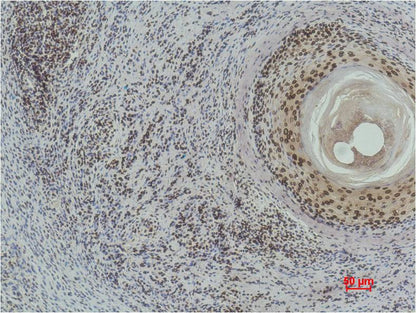 Immunohistochemical analysis of paraffin-embedded Human Skin using  Histone H3(di methyl K9) (EM1108) Mouse mAb diluted at 1:500.