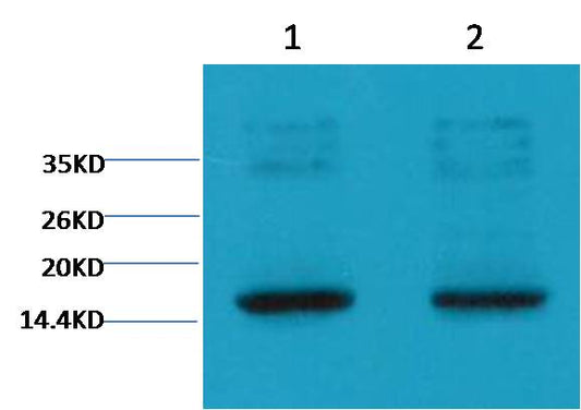 Western blot analysis of Hela with EM1109 diluted at  1) 1:2,000  2) 1:5,000
