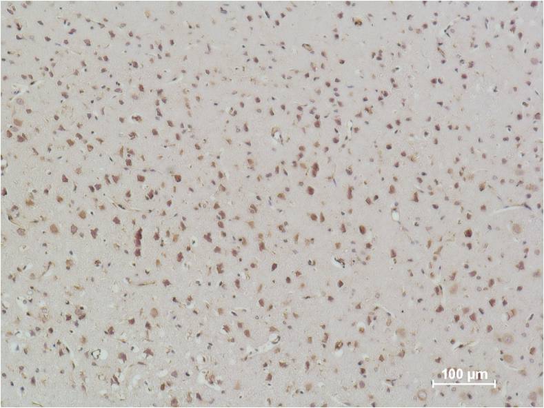Immunohistochemical analysis of paraffin-embedded Rat Brain Tissue using NFkB p65  (EM1111) Mouse mAbdiluted at 1:500.