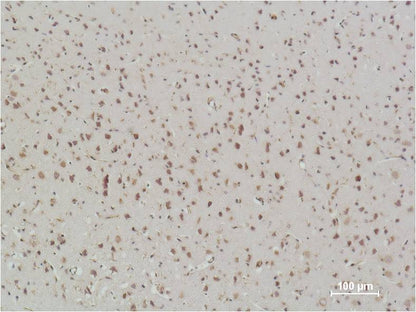 Immunohistochemical analysis of paraffin-embedded Rat Brain Tissue using NFkB p65  (EM1111) Mouse mAbdiluted at 1:500.