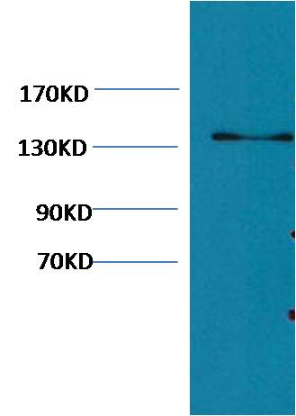 Western blot analysis of Hela with EM1123 diluted at 1:1,000.