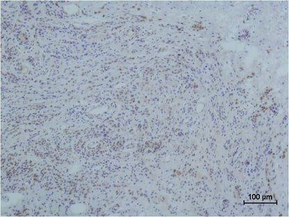 Immunohistochemical analysis of paraffin-embedded human Skin Tissue using Collagen III  (EM1123) Mouse mAb diluted at 1:500.