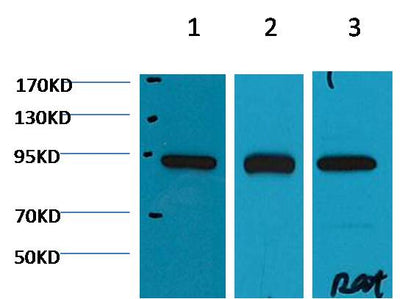 Western blot analysis of 1) Hela, 2) Mouse Brain tissue, 3) Rat Brain tissue with EM1130 diluted at 1:2,000.