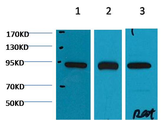 Western blot analysis of 1) Hela, 2) Mouse Brain tissue, 3) Rat Brain tissue with EM1130 diluted at 1:2,000.