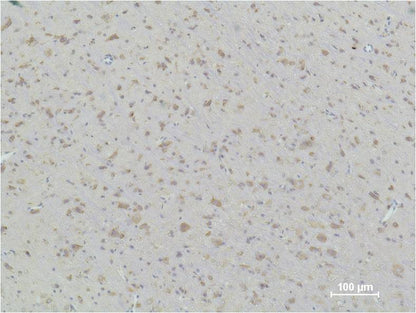 Immunohistochemical analysis of paraffin-embedded Rat Brain Tissue using HSP90b  (EM1130) Mouse mAbdiluted at 1:500.