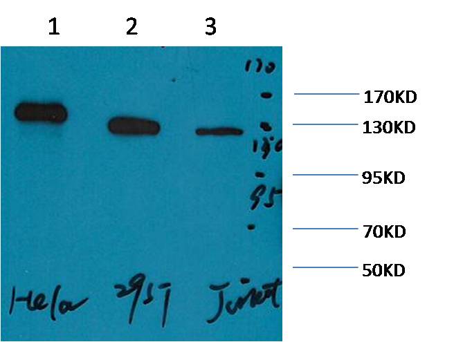 Western blot analysis of 1) Hela, 2) 293T, 3) Jurkat with EM1131 diluted at 1:2,000.
