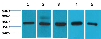 Western blot analysis of 1) 293T ,2) Hela, 3) HepG2, 4) Mouse Brain tissue, 5) Rat Brain tissue with EM1136 diluted at 1:2,000.