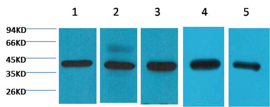 Western blot analysis of 1) 293T ,2) Hela, 3) HepG2, 4) Mouse Brain tissue, 5) Rat Brain tissue with EM1136 diluted at 1:2,000.