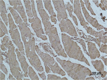 Immunohistochemical analysis of paraffin-embedded  Mouse Skeletal Muscle Tissue using Alpha skeletal muscle actin  (EM1149) Mouse mAb diluted at 1:500.