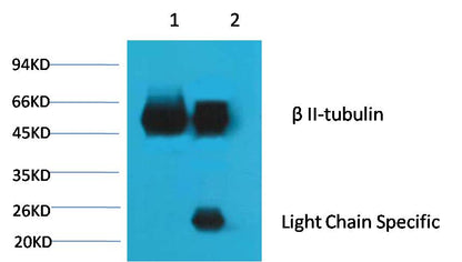 1. Input: Mouse Brain Tissue Lysate  2. IP product: IP dilute 1:200  Western blot analysis: primary antibody : EM1151                    1:10,000  Secondary antibody: Goat anti-Mouse IgG, Light chain specific (S003), 1:5,000