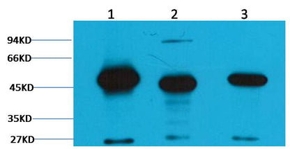 Western blot analysis of 1) Hela, 2)Mouse Brain Tissue , 3) Rat Brain tissue with EM1156 diluted at 1:2,000.