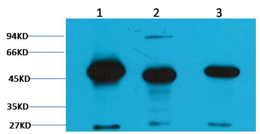 Western blot analysis of 1) Hela, 2)Mouse Brain Tissue , 3) Rat Brain tissue with EM1156 diluted at 1:2,000.