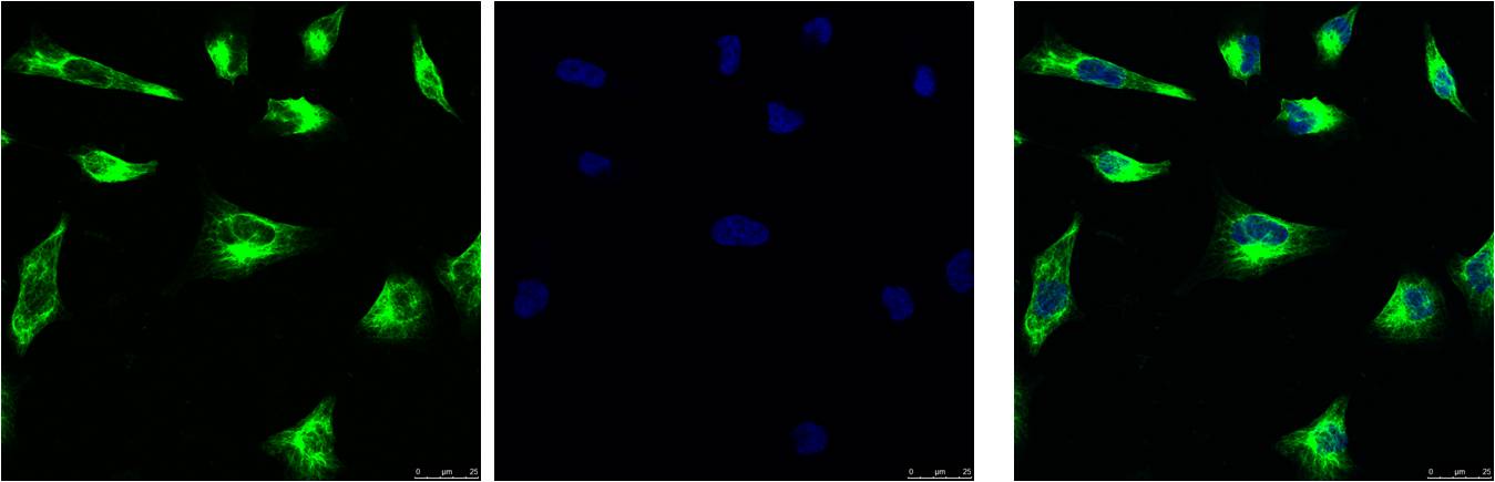 IF analysis of Hela with EM1159(Left) and DAPI (Right) diluted at 1:100.