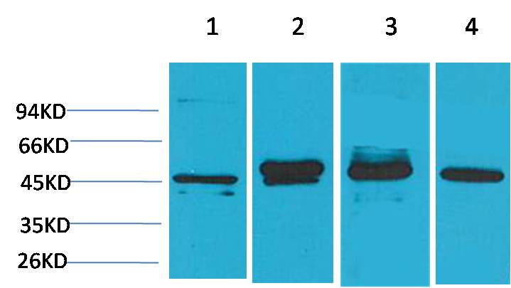 Western blot analysis of 1) Hela, 2) 293T, 3)Mouse Brain Tissue, 4)Rat Brain Tissue with GAP43 Mouse mAb EM1181 diluted at 1:2,000.