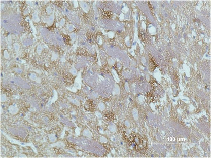Immunohistochemical analysis of paraffin-embedded Rat Brain Tissue using GAP43  (EM1181) Mouse mAb diluted at 1:500.