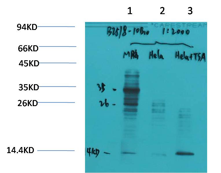Western blot analysis of 1) Mouse Brain Tissue, 2)Hela, 3)Hela+TSA Treated with Acetyl Lysine Mouse mAb EM1191 diluted at 1:2,000.